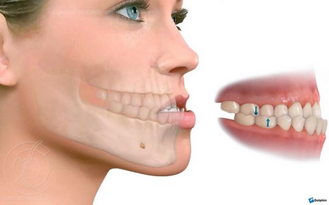 cirugia maxilar gabinete de ortodoncia elche alicante